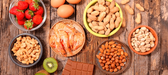 Allergie e intolleranze alimentari Allergie e intolleranze alimentari